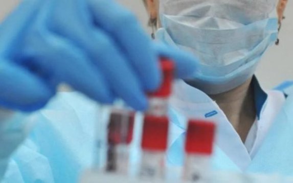 В Харькове зафиксировано 1 тысяча 570 случаев заболевания коронавирусом В Харькове зафиксировано 1 тысяча 570 случаев заболевания коронавирусом