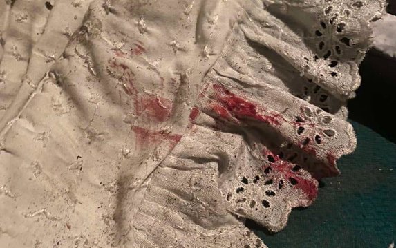 Следователи задержали жительницу Змиевского района, которая едва не лишила жизни знакомого Следователи задержали жительницу Змиевского района, которая едва не лишила жизни знакомого