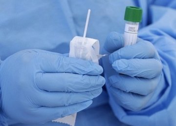 Экспресс-диагностика COVID-19 за 15 минут. В НСЗУ сообщили об изменениях в тестировании пациентов Экспресс-диагностика COVID-19 за 15 минут. В НСЗУ сообщили об изменениях в тестировании пациентов