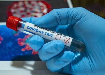 Оперативная информация о распространении коронавирусной инфекции 2019-nCoV