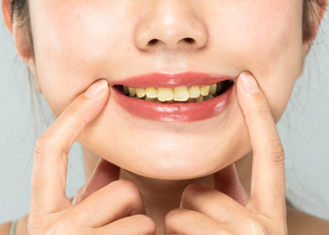 Сильно желтеют зубы: Стоматологи указывают на распространённую ошибку при чистке