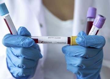 В Харькове – 1 438 новых случаев заболевания коронавирусом В Харькове – 1 438 новых случаев заболевания коронавирусом