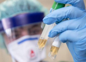 В Харькове – 1 488 новых случаев заболевания коронавирусом