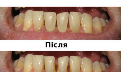 Фото к отзыву