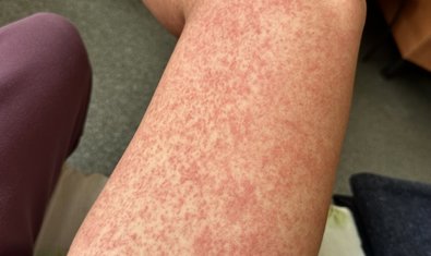 Фото к отзыву