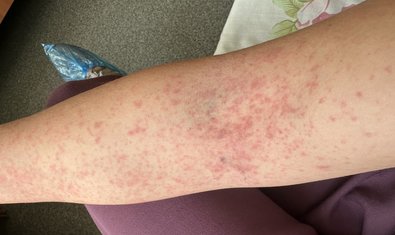 Фото к отзыву