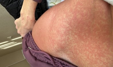 Фото к отзыву