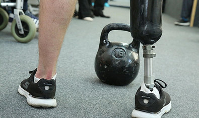 УкрНИИ протезирования г. Харьков