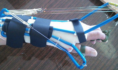 Региональный центр хирургии кисти в ХГКБ №31 Региональный центр хирургии кисти в ХГКБ №31